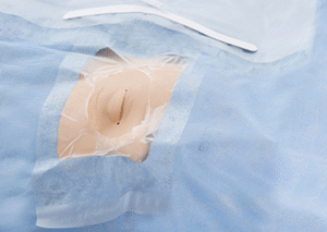 Producto Paquetes Campos Quirúrgicos Ojos y Otorrinolaringología